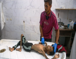 «مجاعة» غزة تتفاقم... وتحذيرات من وفيات بالجملة!